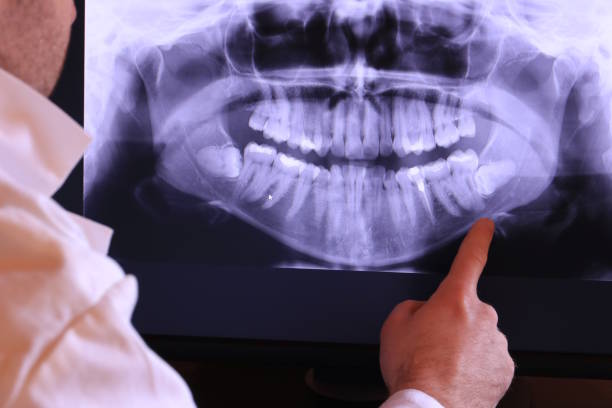 Best Emergency TMJ Treatment in Kingston Springs, TN