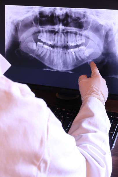 Best Emergency Treatment for Dental Infections or Abscesses in Kingston Springs, TN